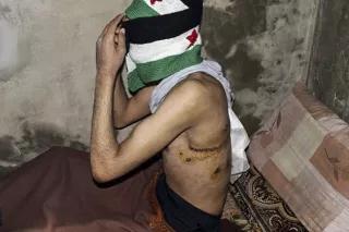 A wounded Syrian refugee, who along with his family fled the Syrian city of Homs, sits next to a pillow at Wadi Khaled village in northern Lebanon, March 28, 2012.